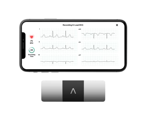 KardiaMobile 6-Lead Personal EKG Monitor – Six Views of The Heart – Detects AFib and Irregular Arrhythmias – Instant Results in 30 Seconds – Works with Most Smartphones - FSA/HSA Eligible