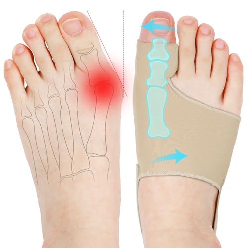 KTSAY 2 Pcs Bunion Corrector for Women & Men, Bunion Socks Toe Corrector Comfortable & Breathable for Day/Night Support, Hallux Valgus Pain Relief Non-Slip Big Toe Straightener (1# Beige)