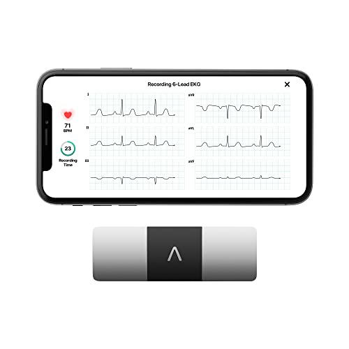 KardiaMobile 6-Lead Personal EKG Monitor – Six Views of The Heart – Detects AFib and Irregular Arrhythmias – Instant Results in 30 seconds – Works with Most Smartphones - FSA/HSA Eligible