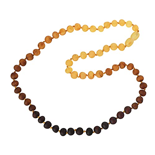 Baltic Amber Necklace - Adult Raw Amber Bead Necklace - Rainbow Pattern Unpolished Amber Beads - Multiple Lengths (21.7)