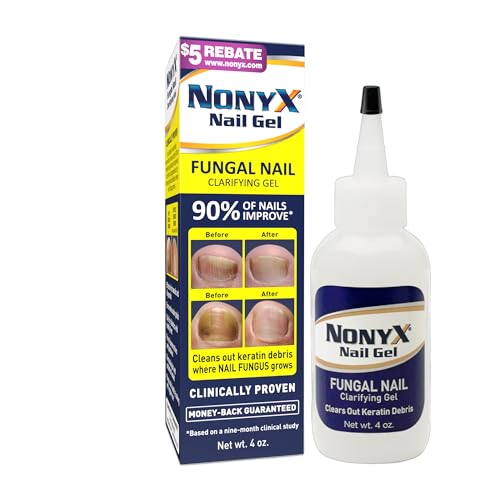NONYX Fungal Nail Clarifying Gel | Rids Nails of Fungus by Removing Keratin Debris Where Nail Fungus Grows | 90% of Toenails Improved Using this Toenail Fungus Treatment | 4 oz