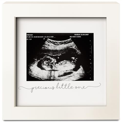 Baby Sonogram Picture Frame - Modern Ultrasound Frame for Mom to Be - Pregnancy Announcement Sonogram Photo Frames - Gender Reveal for Expecting Parents - First Time Dad Gifts (Alpine White)
