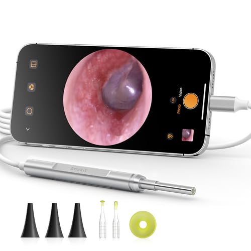 Anykit Digital Otoscope for Phone d & Tablet, Ultra Clear View Ear Camera with Ear Wax Removal Tools, Video Ear Scope Otoscope with Light, Support Capture Photo & Record Videos