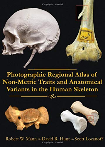 Photographic Regional Atlas of Non-Metric Traits and Anatomical Variants in the Human Skeleton