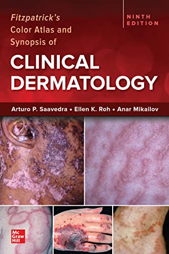 Fitzpatrick's Color Atlas and Synopsis of Clinical Dermatology, 9/e