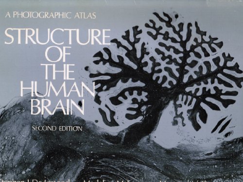 Structure of the Human Brain: A Photographic Atlas